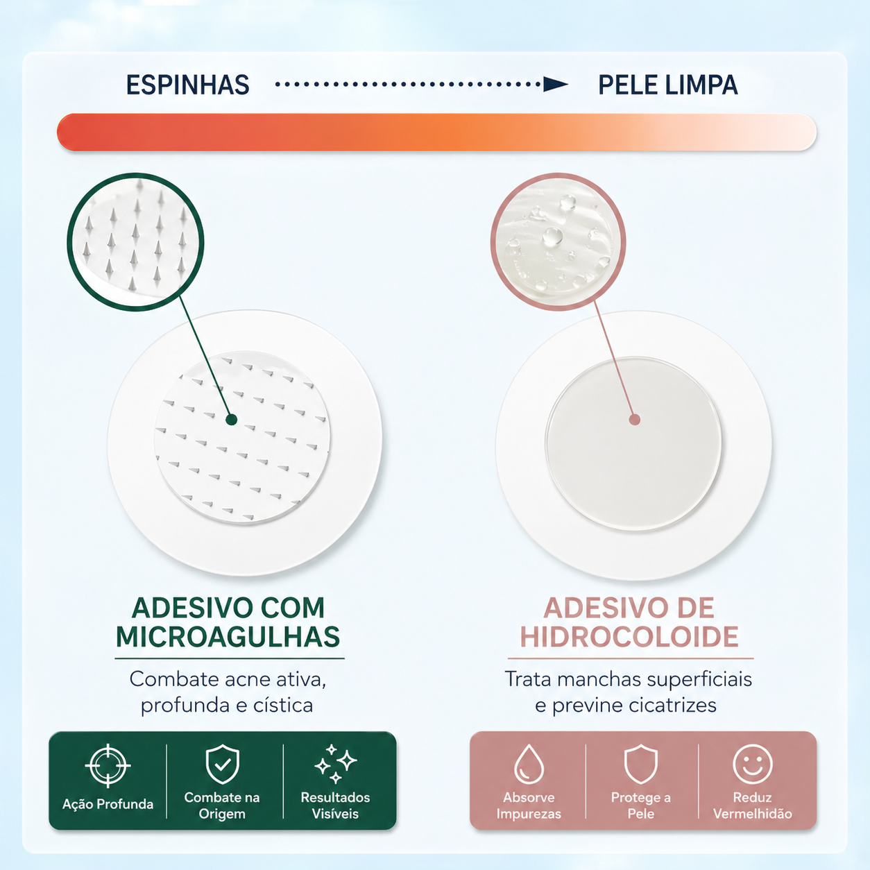 Adesivo Anti Acne com Microagulhas – Resultado Rápido