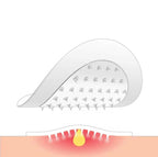 Adesivo Anti Acne com Microagulhas – Resultado Rápido