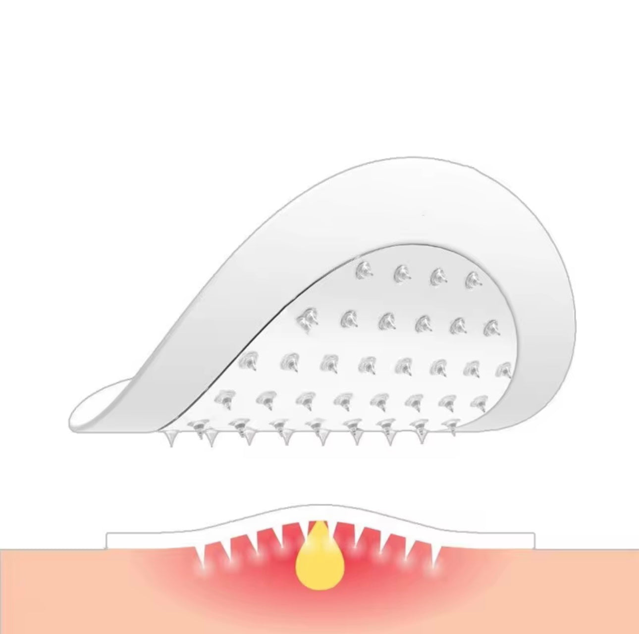 Adesivo Anti Acne com Microagulhas – Resultado Rápido